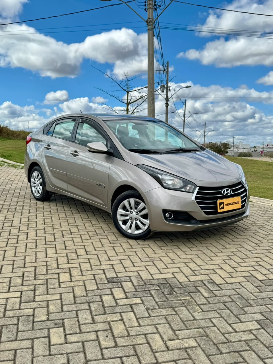 Hyundai HB20S